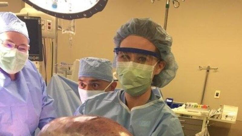 One month ago Kayla Rahn had this 50-pound cyst removed from her body. (Source: Jackson Hospital)